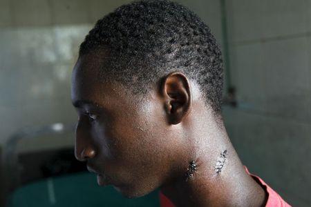 Alassane Diallo, 17, a supporter of presidential candidate Cellou Dalein Diallo, sits on a bed at a clinic after being wounded on his neck by a bullet during clashes between security forces and opposition supporters, in Conakry, October 14, 2015. PHOTO BY REUTERS/Luc Gnago