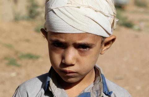 Mukhtar Hadi, who survived a Saudi-led air strike that killed dozens including children, stands outside his house in Saada, Yemen September 4, 2018. Picture taken September 4, 2018. REUTERS/Naif Rahma