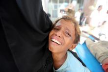 A boy cries at al-Thawra Hospital after his brother was injured in a strike near the hospital in Hodeidah, Yemen, August 2, 2018. PHOTO BY REUTERS/Abduljabbar Zeyad