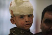 A displaced child who was injured in clashes and fleeing from Islamic State militants of Mosul, receives treatment at a hospital west of Erbil, Iraq, November 25, 2016. PHOTO BY REUTERS/Azad Lashkari
