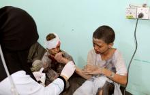 A doctor treats children injured by an airstrike in Saada, Yemen, August 9, 2018. PHOTO BY REUTERS/Naif Rahma