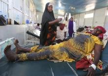 A woman recovers from effects of drinking contaminated water from a well, at a hospital in Yaqshid district in Somalia's capital Mogadishu December 13, 2014. PHOTO BY REUTERS/Feisal Omar