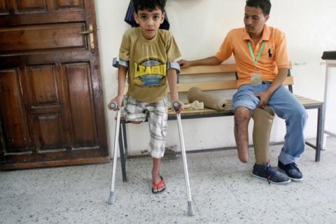 People with amputated legs are at a prosthetic limbs centre in southwestern city of Taiz, Yemen, May 16, 2016. PHOTO BY REUTERS/Anees Mahyoub