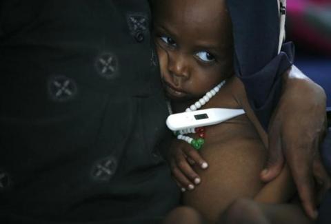 A malnourished baby has his temperature checked inside Medicine Sans Frontieres facility near Sheshemene, southern Ethiopia. PHOTO BY REUTERS/Radu Sigheti