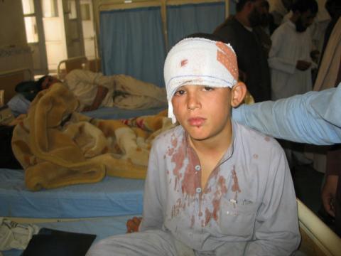 A boy who was injured during exchange of fire between Pakistan and Afghan forces on the border area recieves treatment after he was brought to a hospital in Chaman, Pakistan, May 5, 2017. PHOTO BY REUTERS/Saeed Ali Achakzai