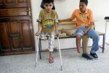 People with amputated legs are at a prosthetic limbs centre in southwestern city of Taiz, Yemen, May 16, 2016. PHOTO BY REUTERS/Anees Mahyoub