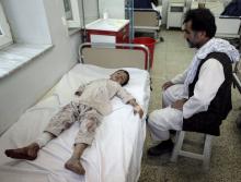 An Afghan boy receives treatment at a hospital after a bomb blast in northern Mazar-i-Sharif, Afghanistan, October 12, 2016. PHOTO BY REUTERS/Anil Usyan
