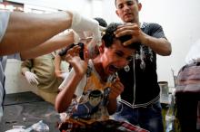 A boy reacts as medics attend to him after he was injured by crossfire during clashes between pro-government fighters and Houthi fighters in the southwestern city of Taiz, Yemen, June 2, 2017. PHOTO BY REUTERS/Anees Mahyoub