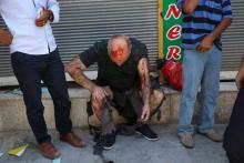 A wounded man sits on a step following an explosion in Suruc, in the southeastern Sanliurfa province, Turkey, July 20, 2015. PHOTO BY REUTERS/Ozcan Soysal